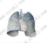 心肺塑化标本